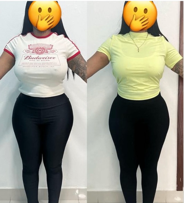 Female client, shape and definition